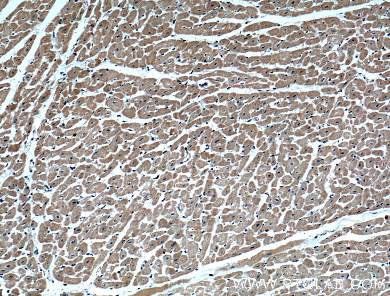 IHC staining of human heart using 15289-1-AP