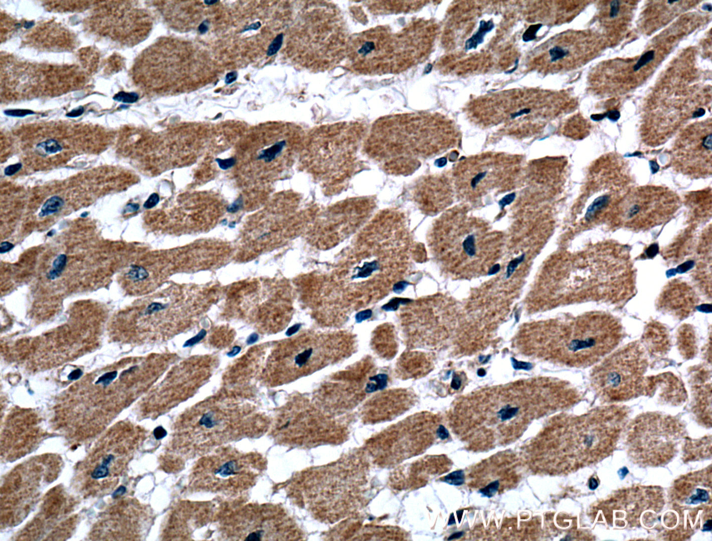 IHC staining of human heart using 15289-1-AP