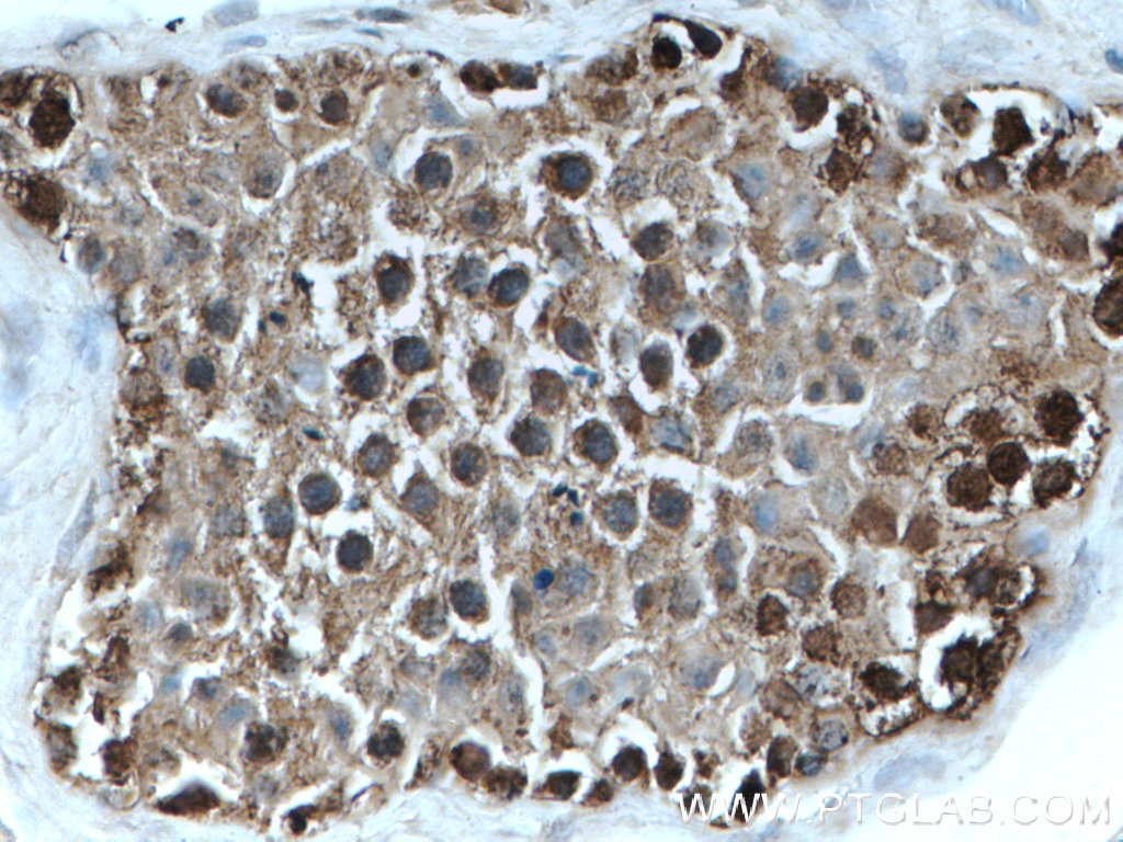 IHC staining of human testis using 11117-1-AP