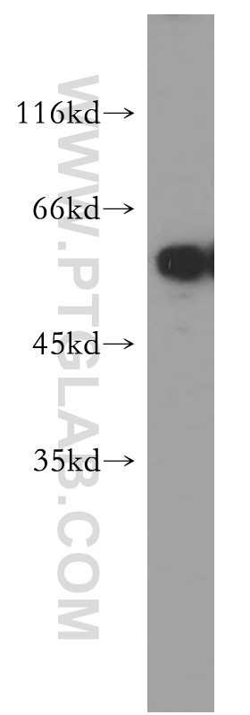 TXNRD1 Polyclonal antibody