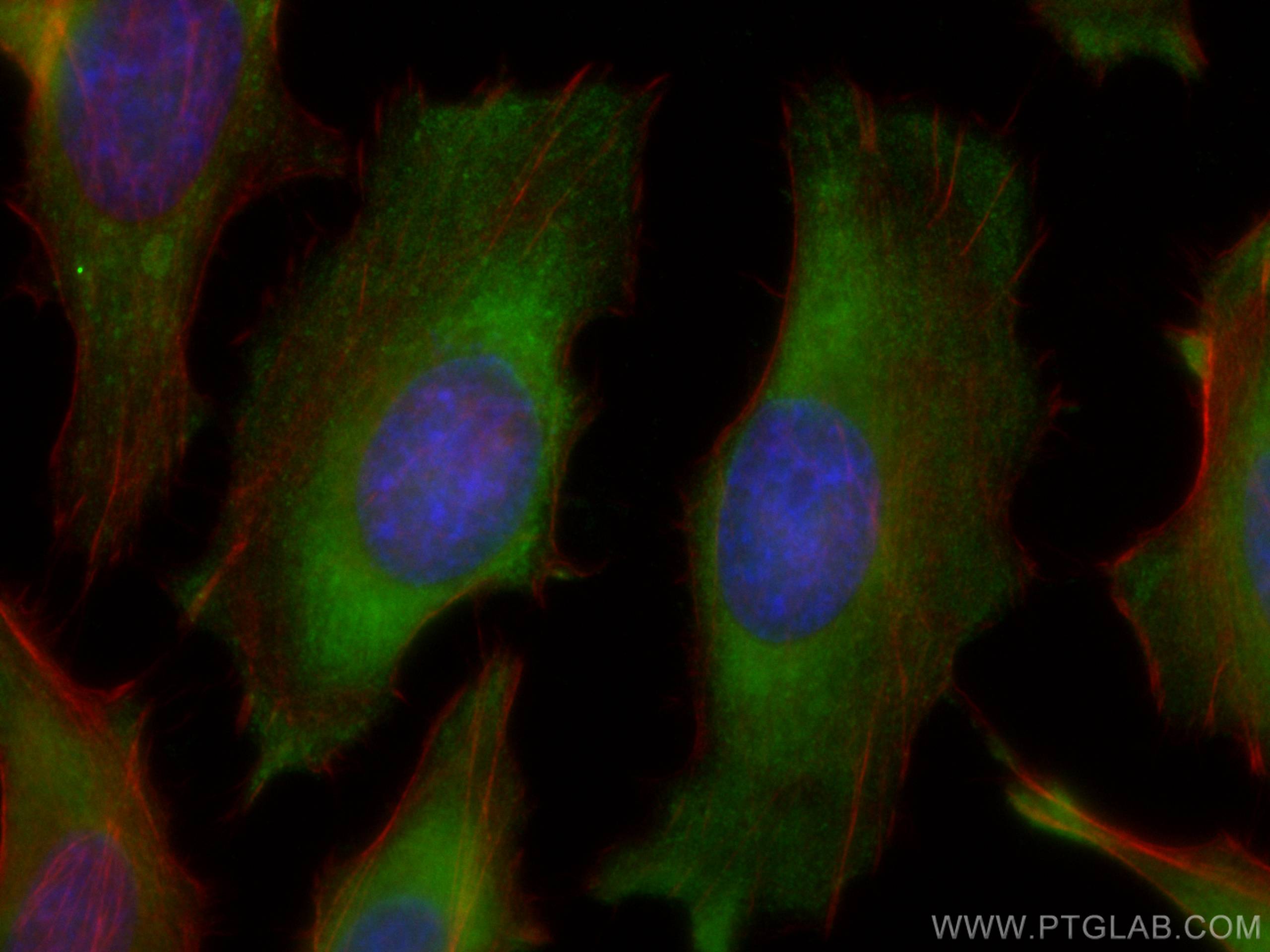 IF Staining of HeLa using 67728-1-Ig (same clone as 67728-1-PBS)