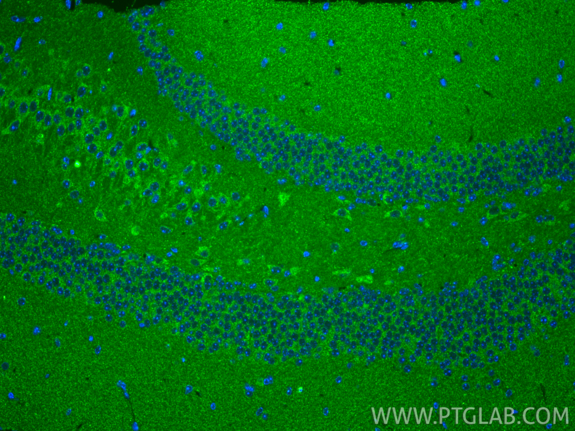 IF Staining of mouse brain using 85424-1-RR