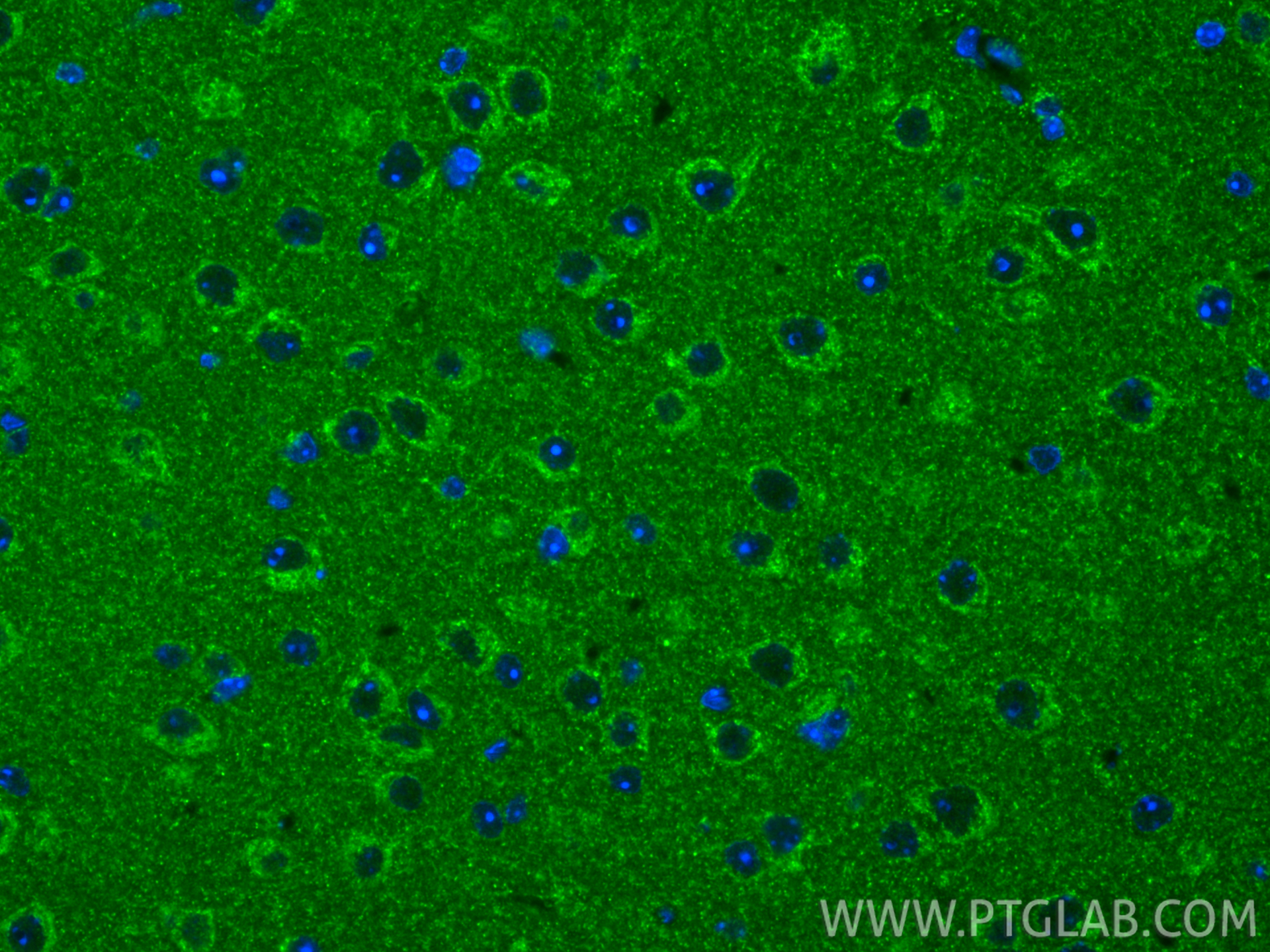 IF Staining of mouse brain using 85424-1-RR