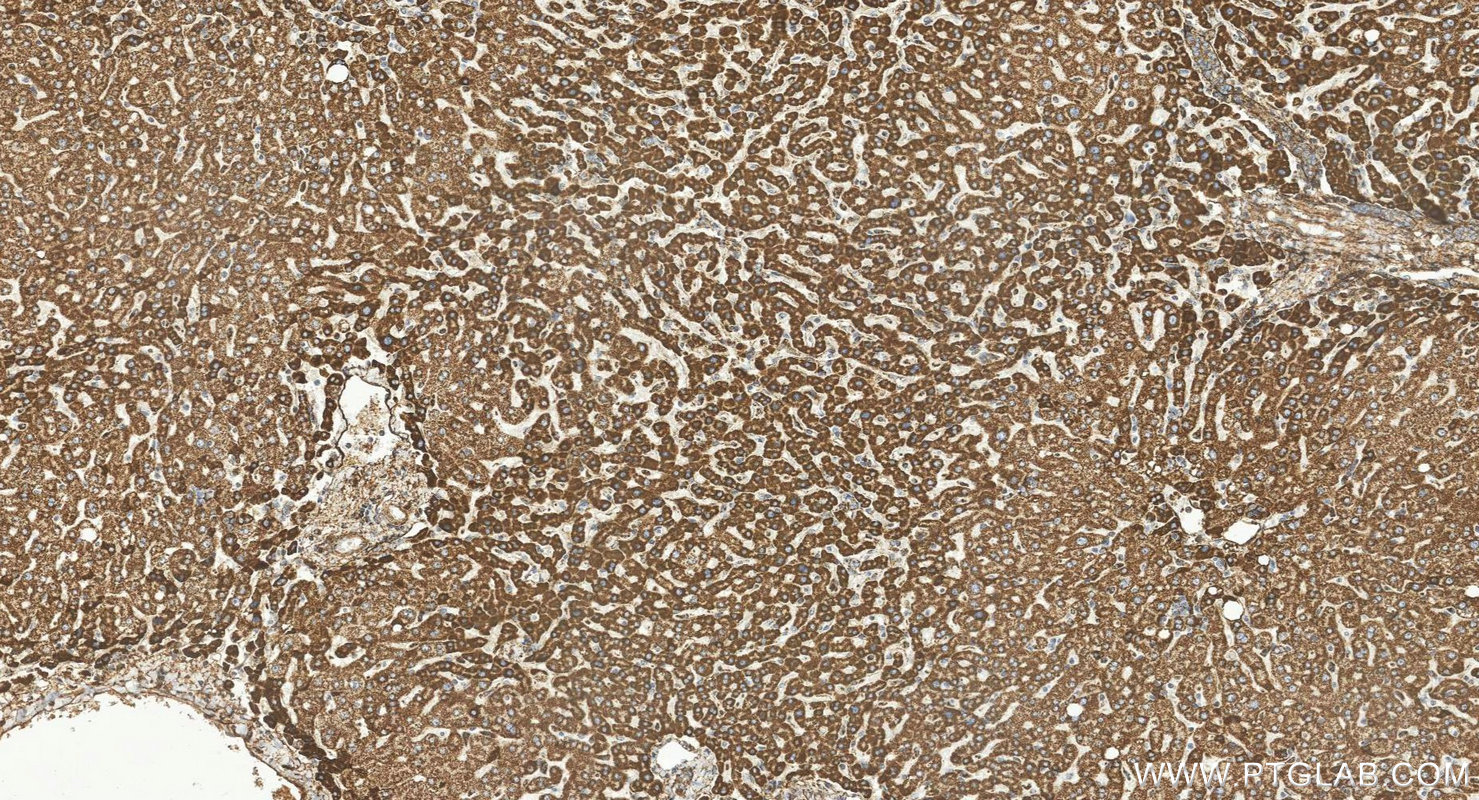 IHC staining of human liver using 85424-1-RR