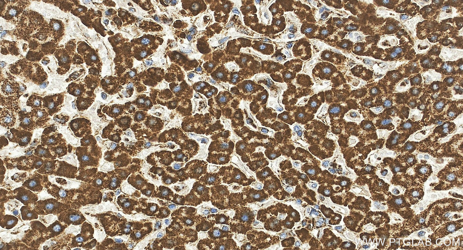 IHC staining of human liver using 85424-1-RR