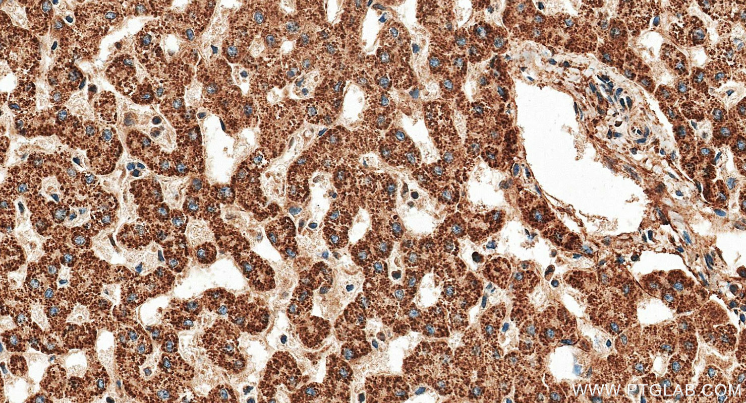 IHC staining of human liver using RMX00099