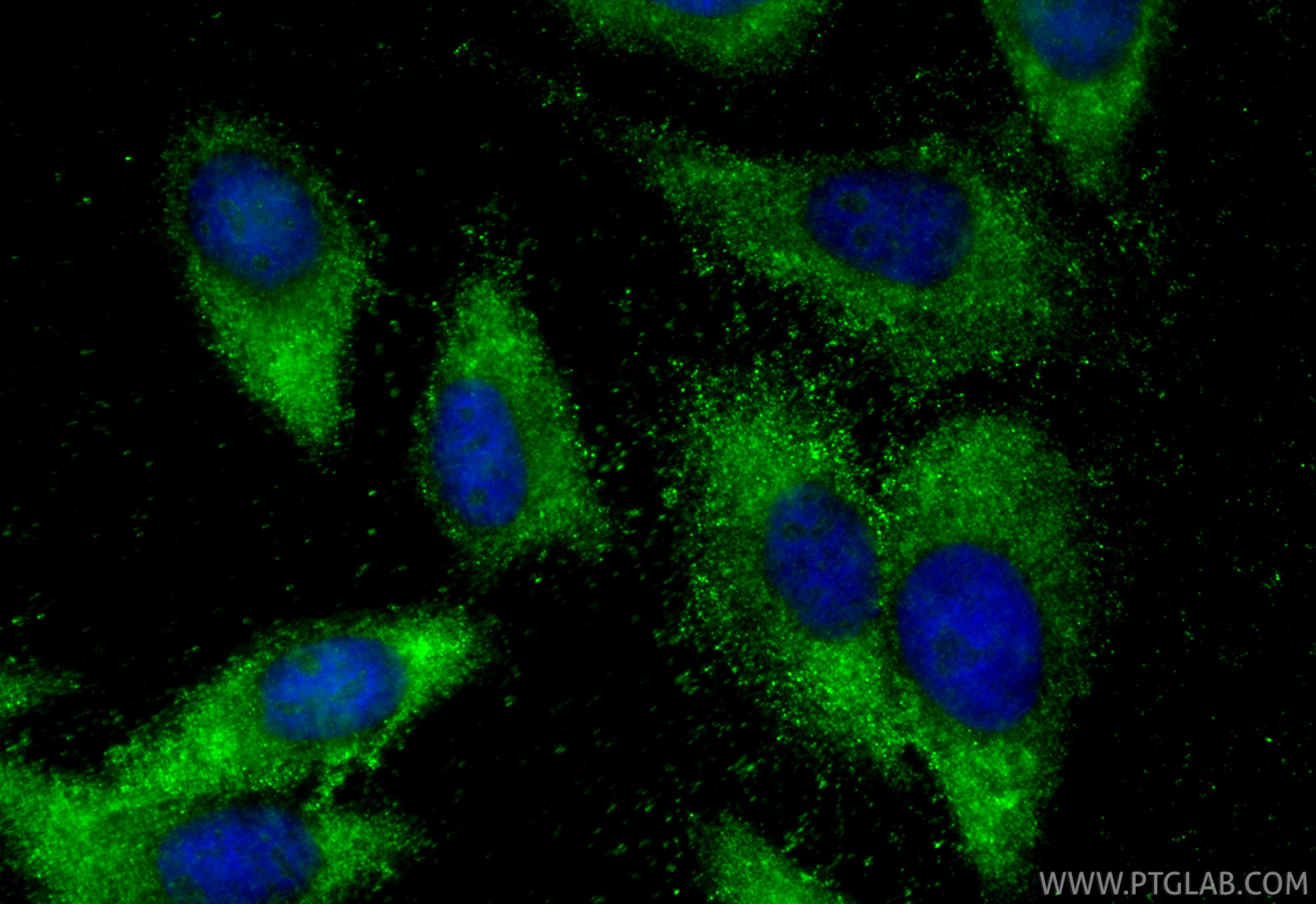Immunofluorescent analysis of (-20°C Ethanol) fixed HepG2 cells using TYK2 antibody (30838-1-AP) at dilution of 1:200 and CoraLite®488-Conjugated Goat Anti-Rabbit IgG(H+L) (<a class='green' href='/productredirect?CatalogNo=SA00013-2' target='_blank'>SA00013-2</a>). IF Staining of HepG2 using 30838-1-AP