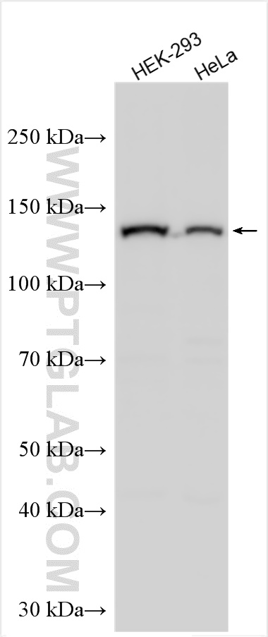 WB analysis using 30838-1-AP