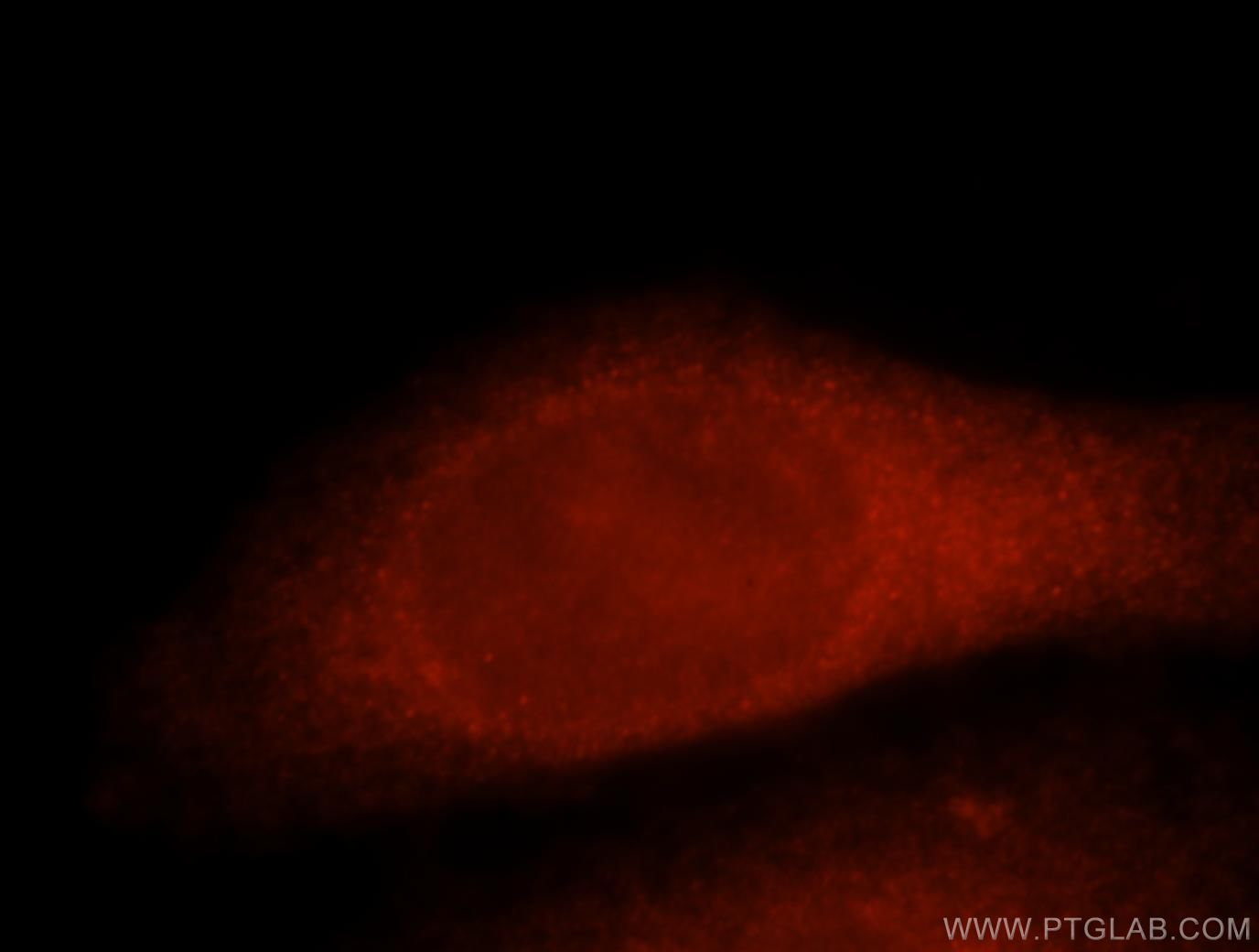 Thymidylate synthase