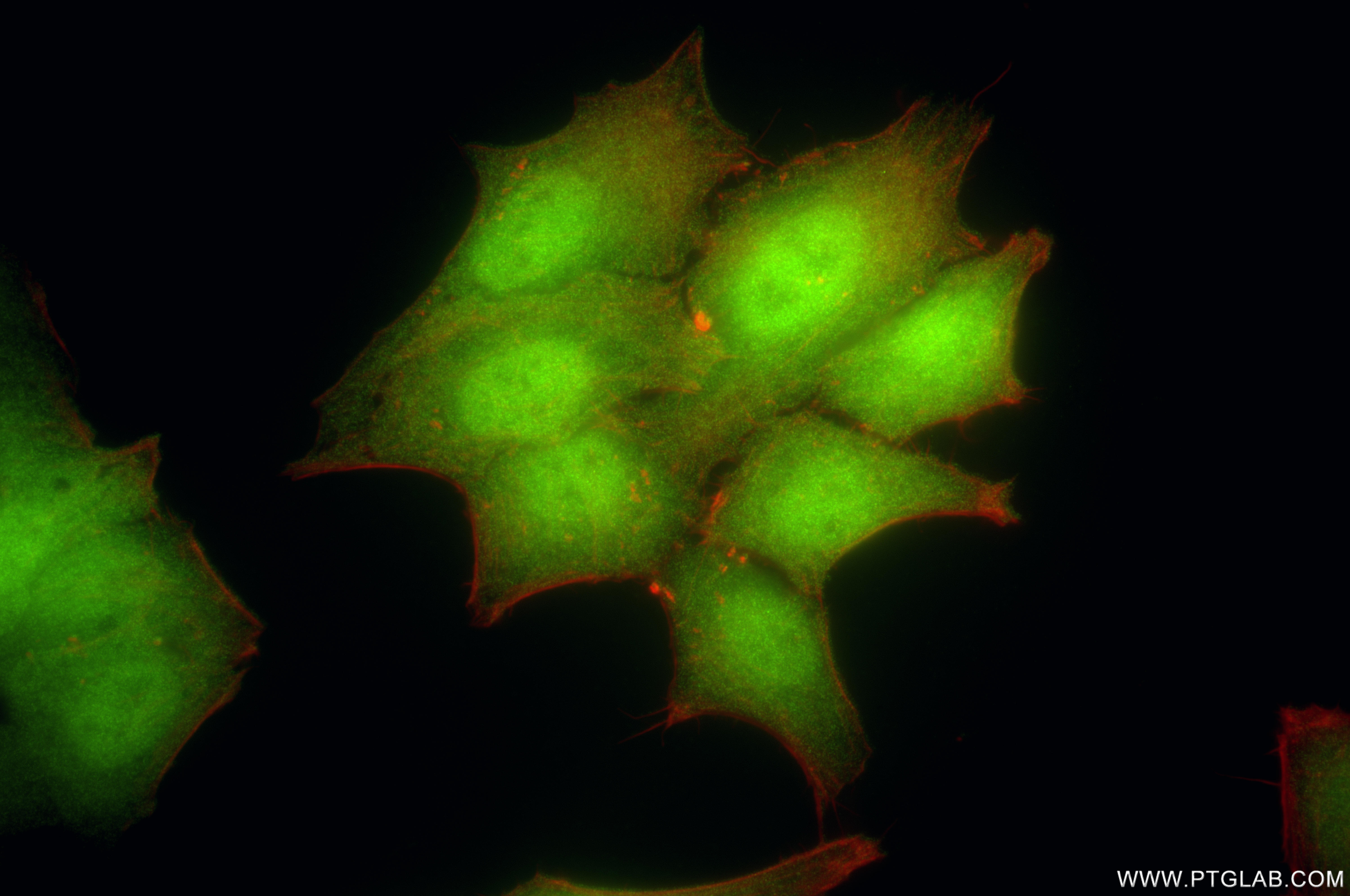 IF Staining of HepG2 using 86643-1-RR IF Staining of HepG2 using 86643-1-RR