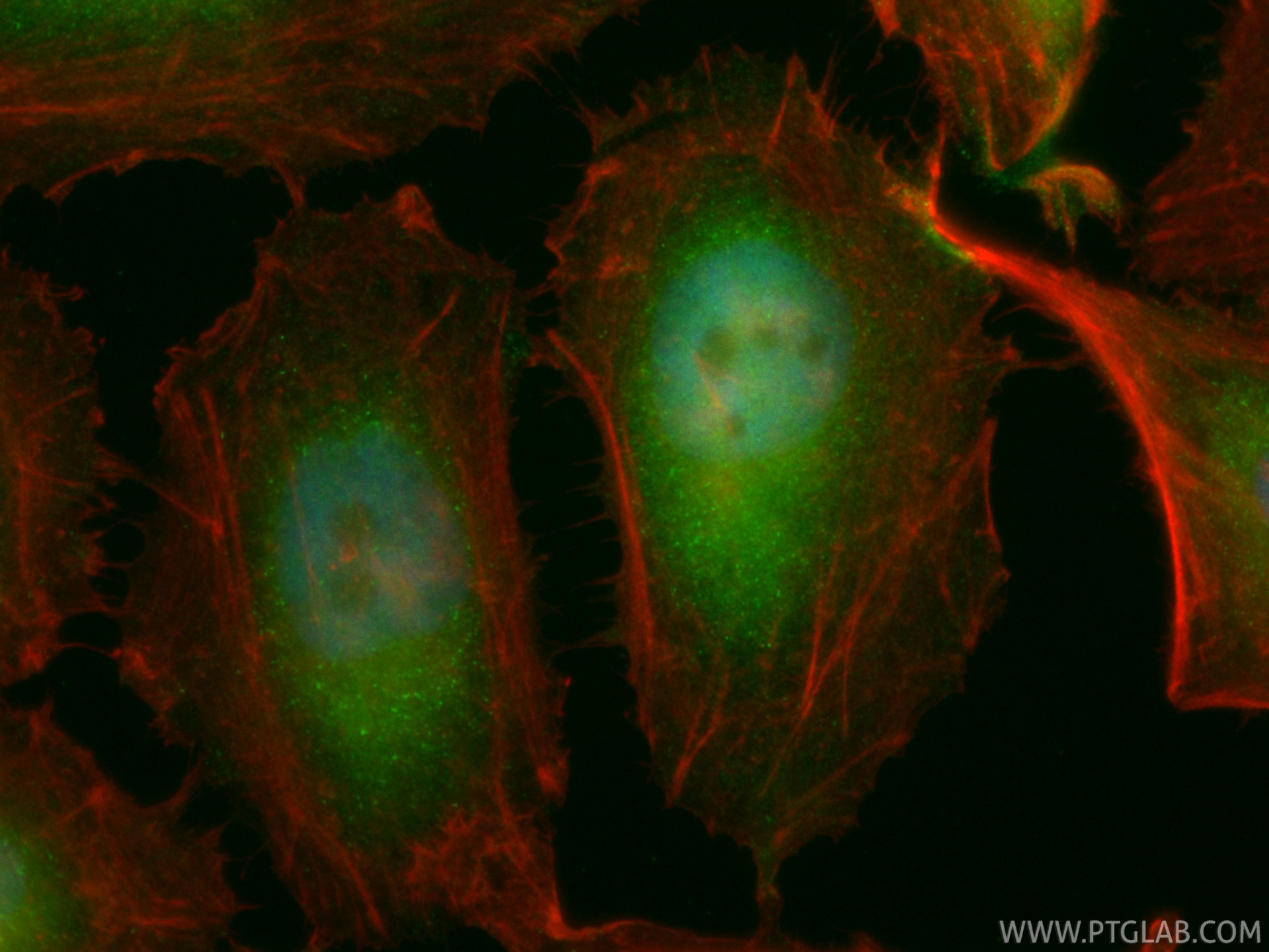 IF Staining of HeLa using CL488-86643 IF Staining of HeLa using CL488-86643