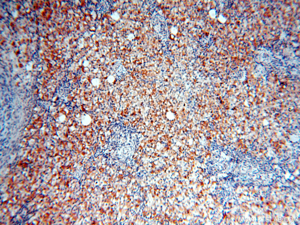 IHC staining of human ovary using 17665-1-AP