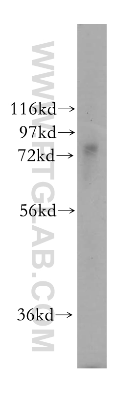 WB analysis of mouse liver using 17665-1-AP