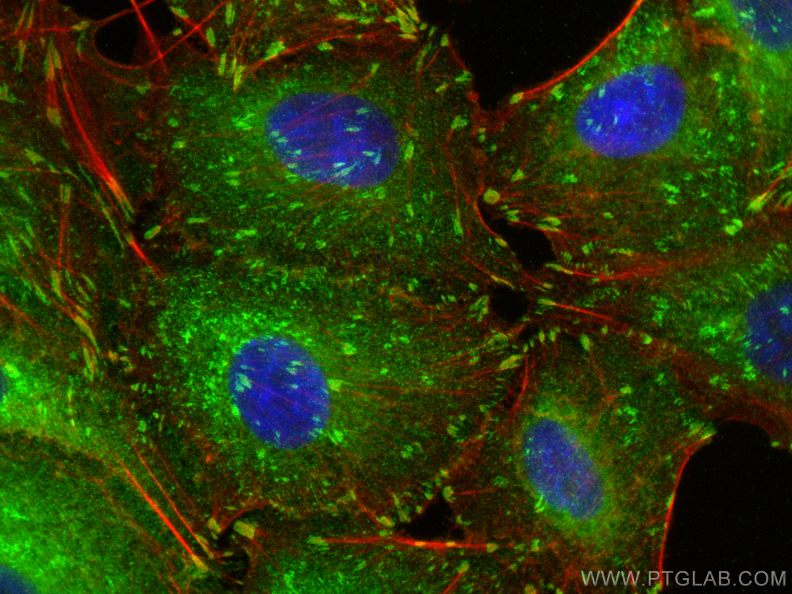 IF Staining of A549 using 82856-4-RR