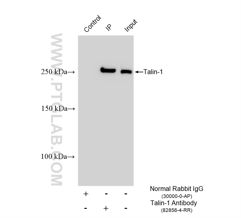 IP experiment of HeLa using 82856-4-RR