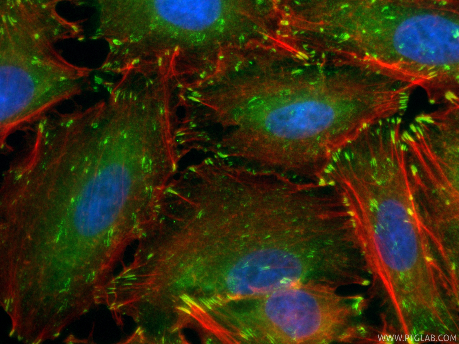 IF Staining of A549 using CL488-82856-4