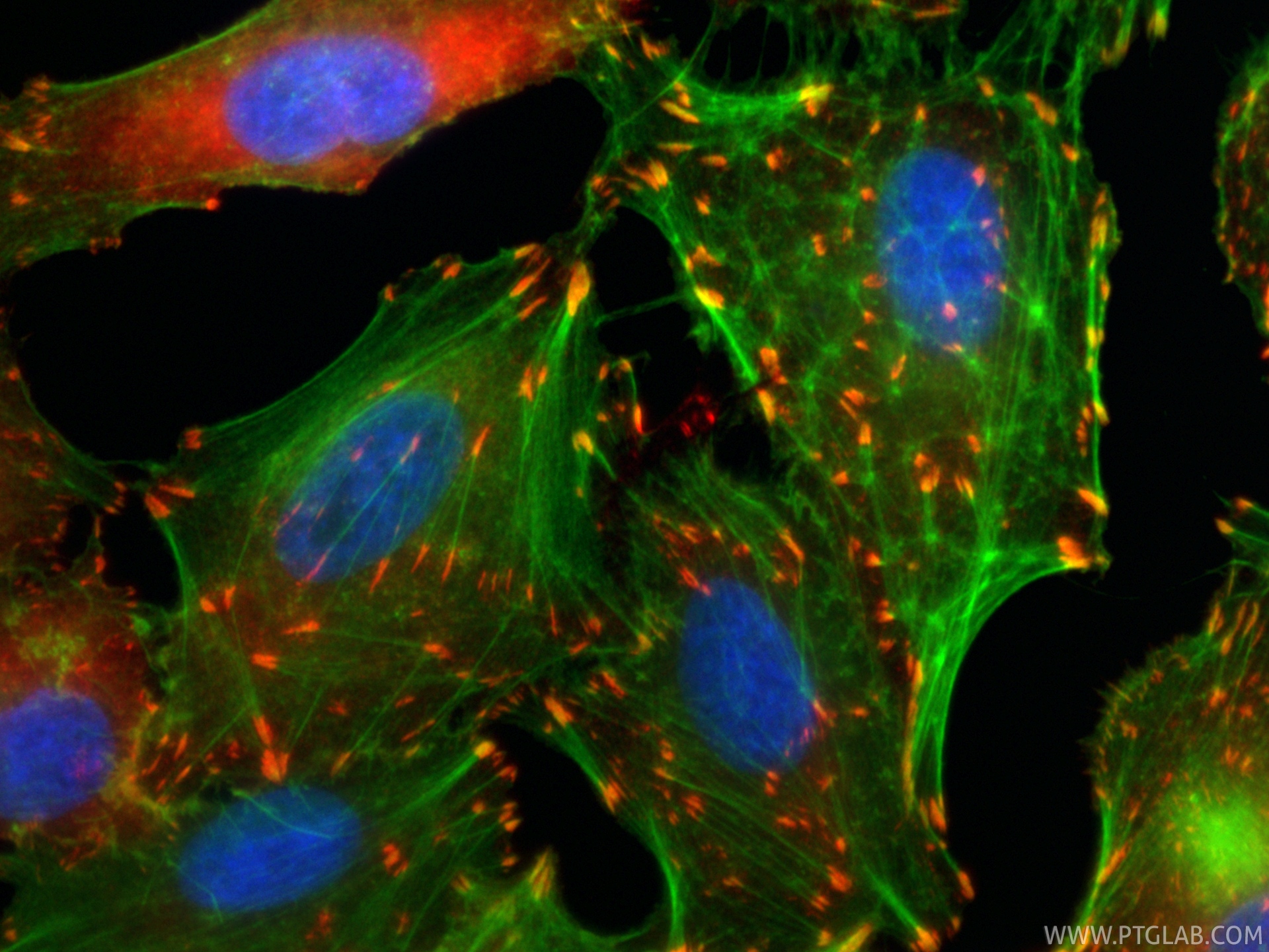 IF Staining of A549 using CL594-82856-4