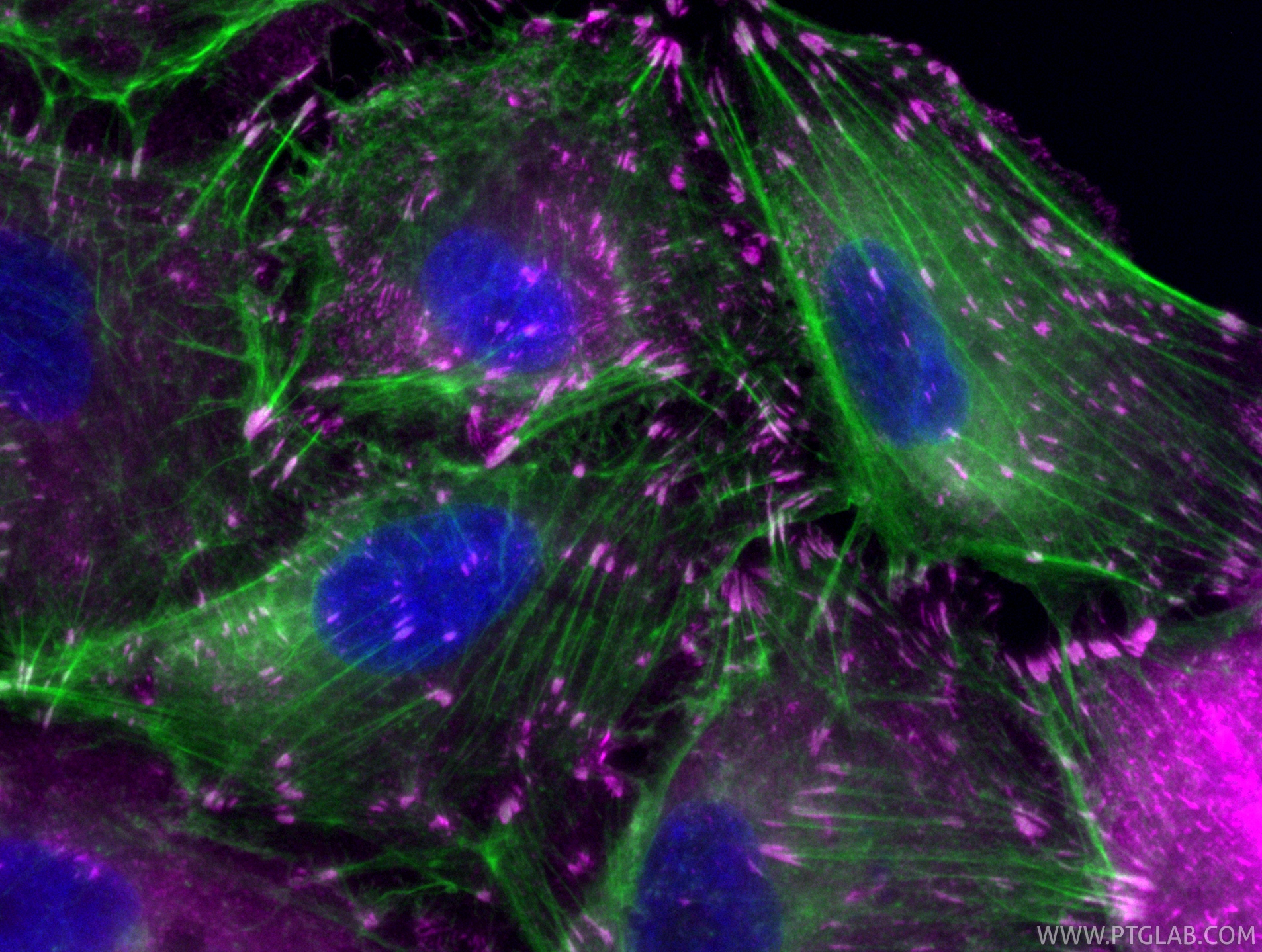 Immunofluorescent analysis of (4% PFA) fixed A549 cells using CoraLite® Plus 647 Talin-1 antibody (CL647-82856-4, Clone: 7D11 ) at dilution of 1:200, CL488-phalloidin (green). IF Staining of A549 using CL647-82856-4