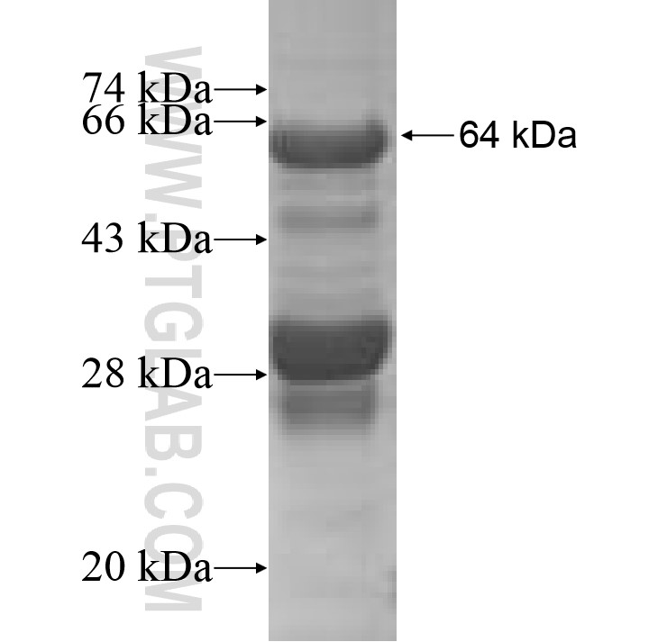 Tdrd7 fusion protein Ag7912 SDS-PAGE Tdrd7 fusion protein Ag7912 SDS-PAGE