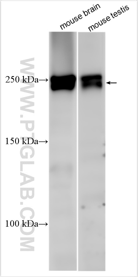 WB analysis using 31971-1-AP