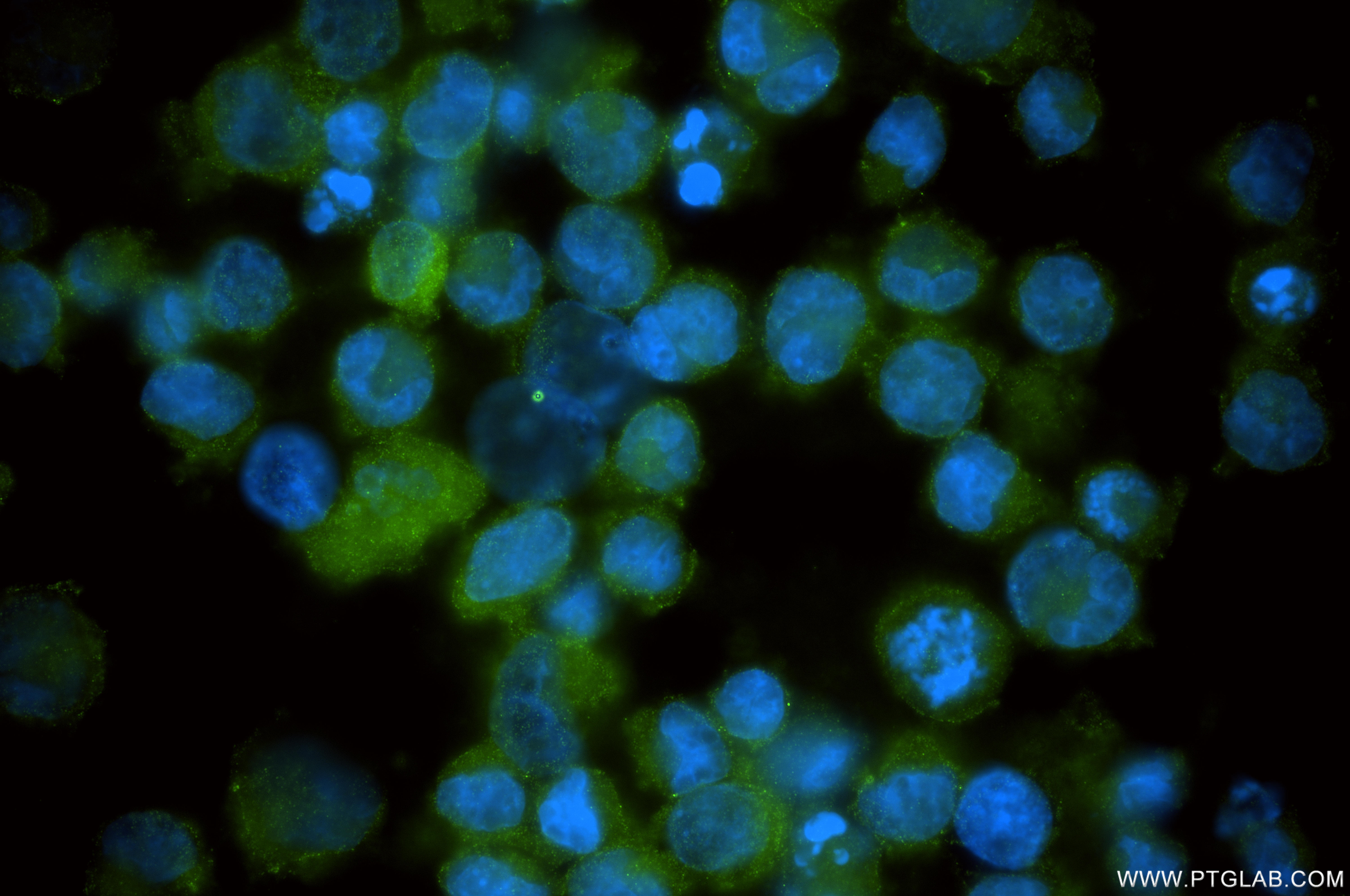 IF Staining of K-562 using 86013-3-RR (same clone as 86013-3-PBS) IF Staining of K-562 using 86013-3-RR (same clone as 86013-3-PBS)