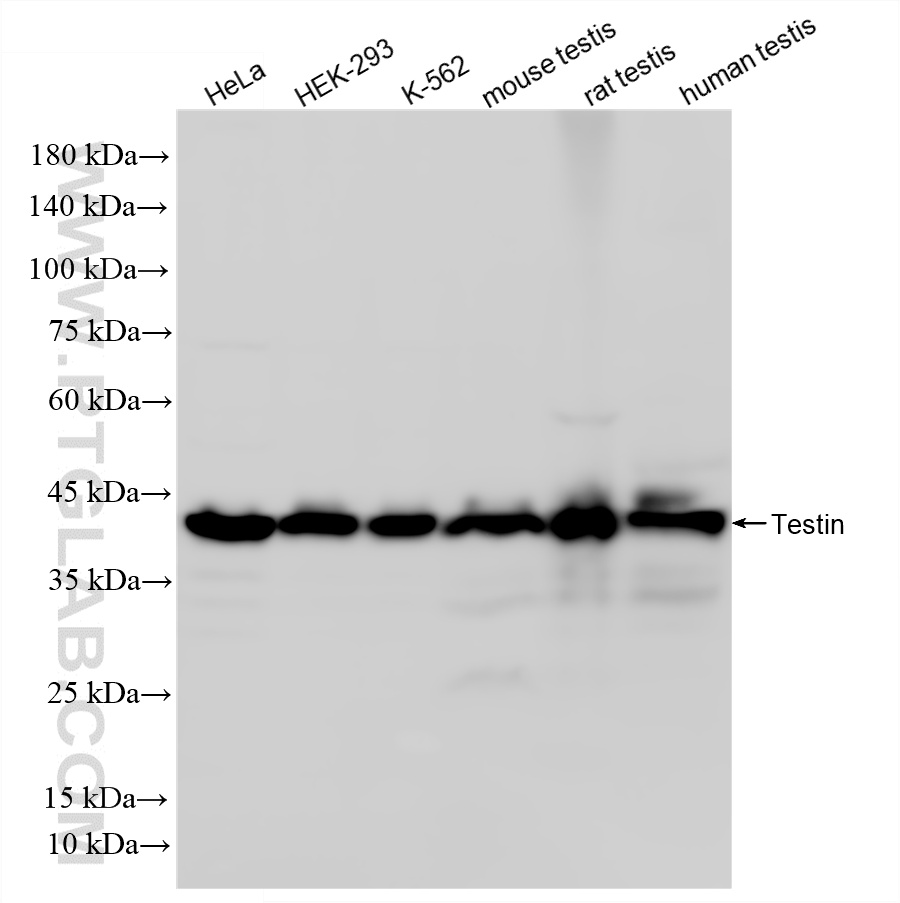 WB analysis using 86013-3-RR (same clone as 86013-3-PBS) WB analysis using 86013-3-RR (same clone as 86013-3-PBS)
