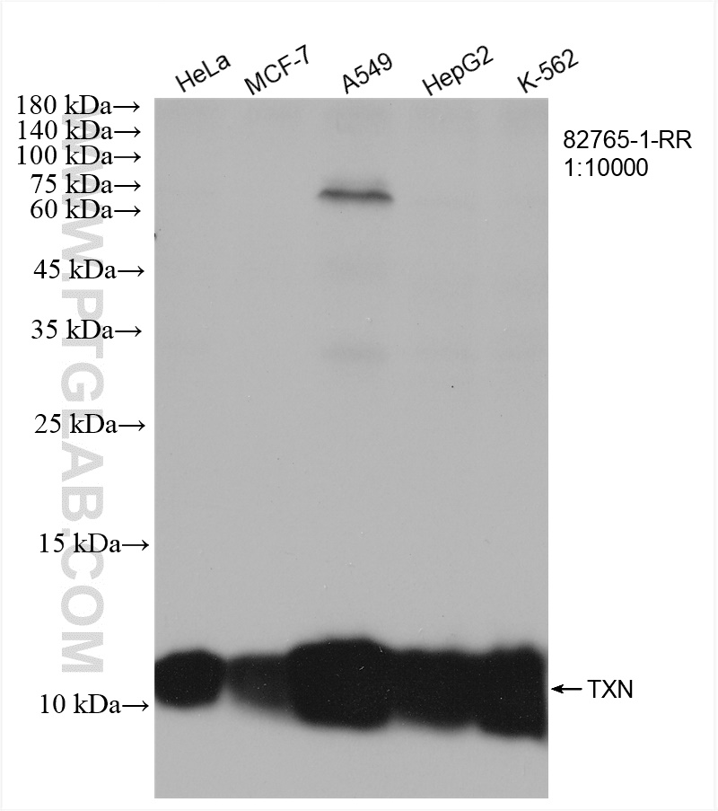 Thioredoxin