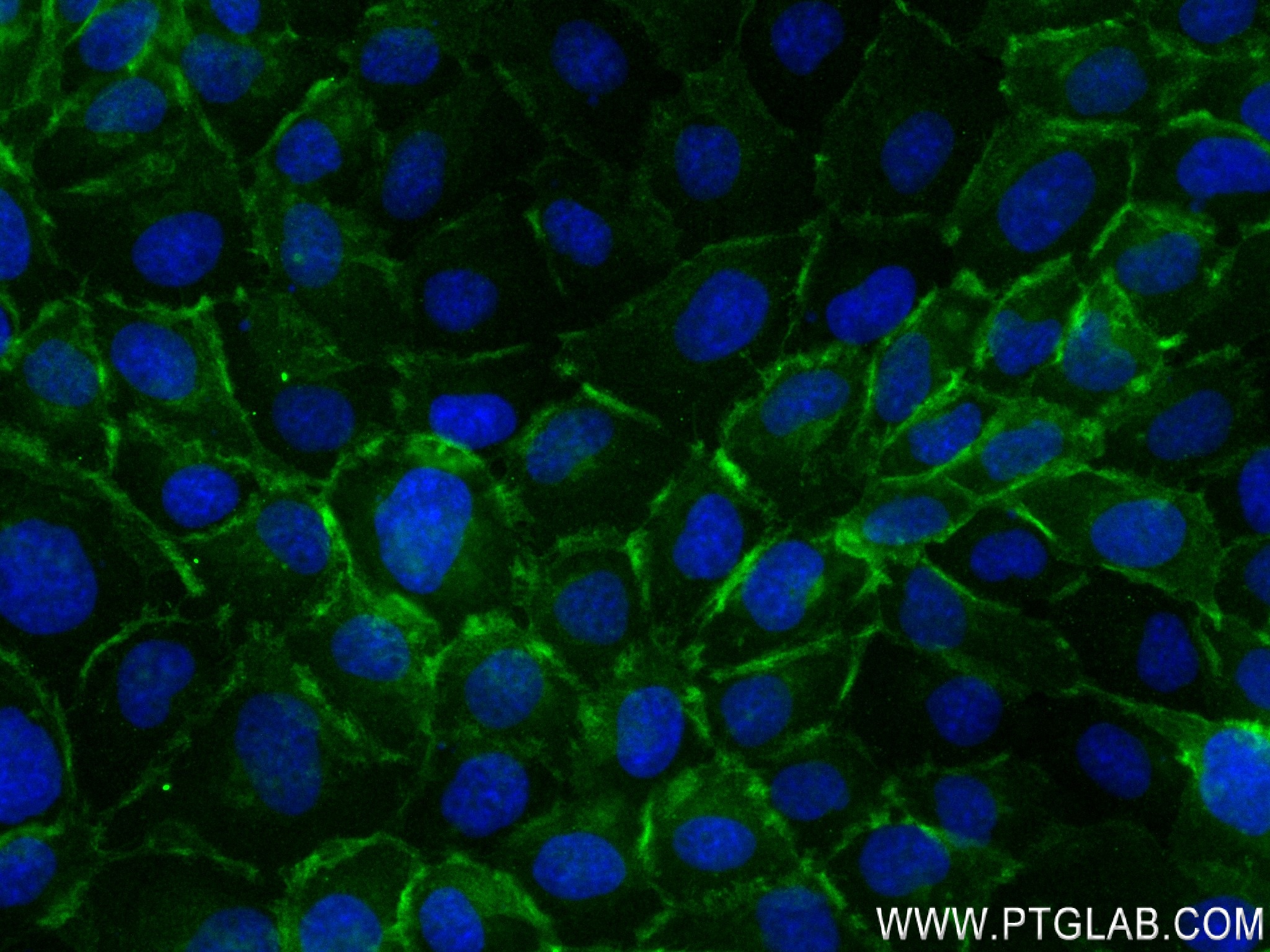 IF Staining of A431 using 83416-4-RR