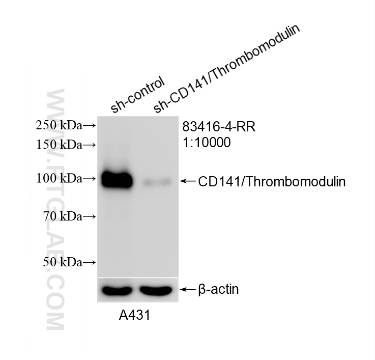 WB result of CD141/Thrombomodulin antibody (83416-4-RR; 1:10000; incubated at room temperature for 1.5 hours) with sh-Control and sh-CD141/Thrombomodulin transfected A431 cells. WB analysis of A431 using 83416-4-RR