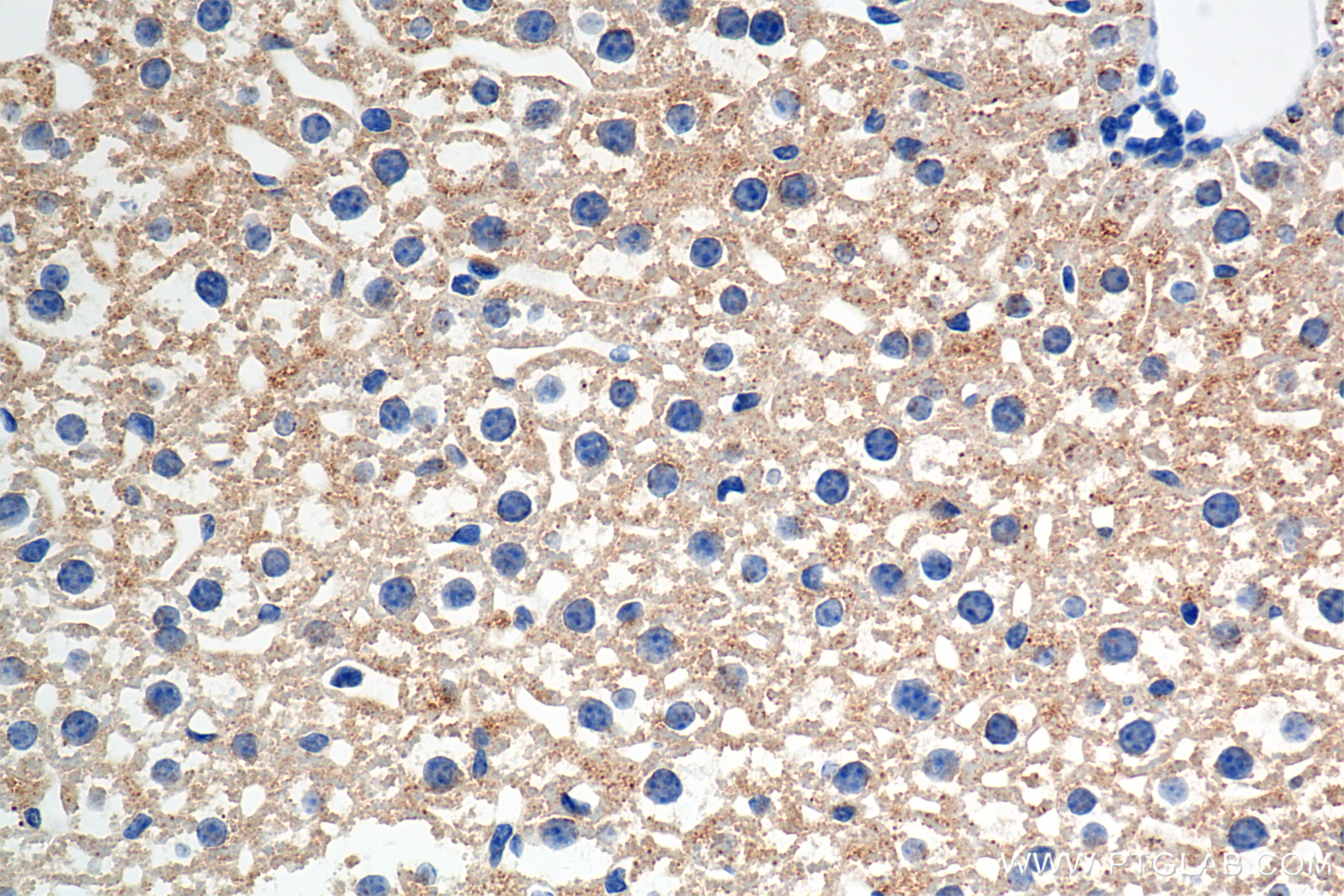 IHC staining of mouse liver using 83549-7-RR