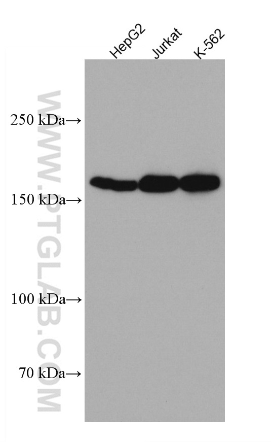 WB analysis using 67241-1-Ig