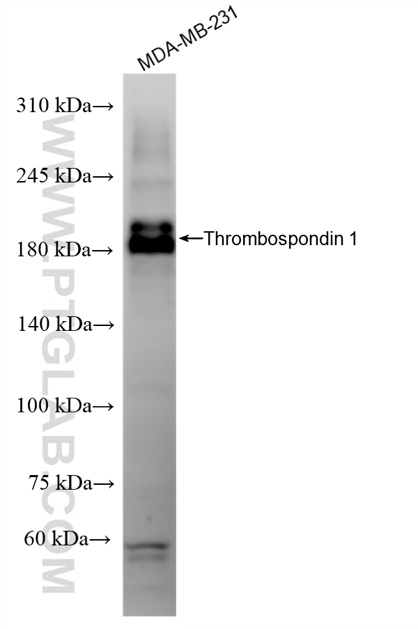 WB analysis of MDA-MB-231 using 88117-1-RR