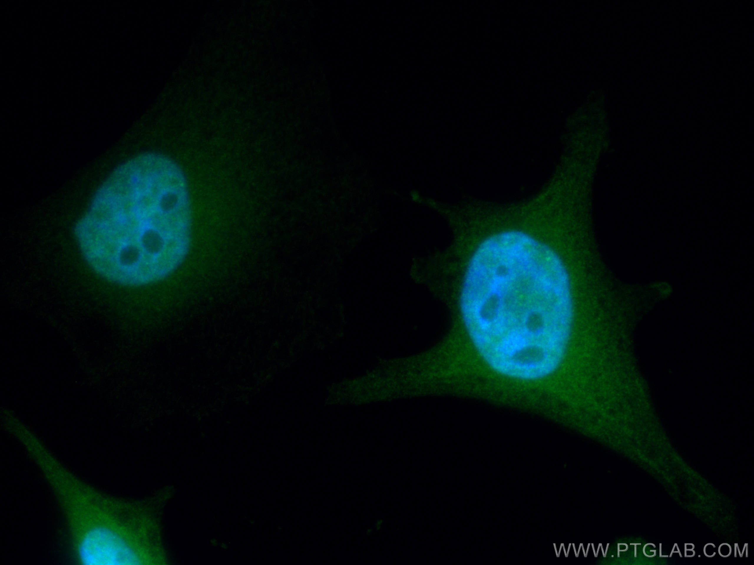 Thymidylate synthase