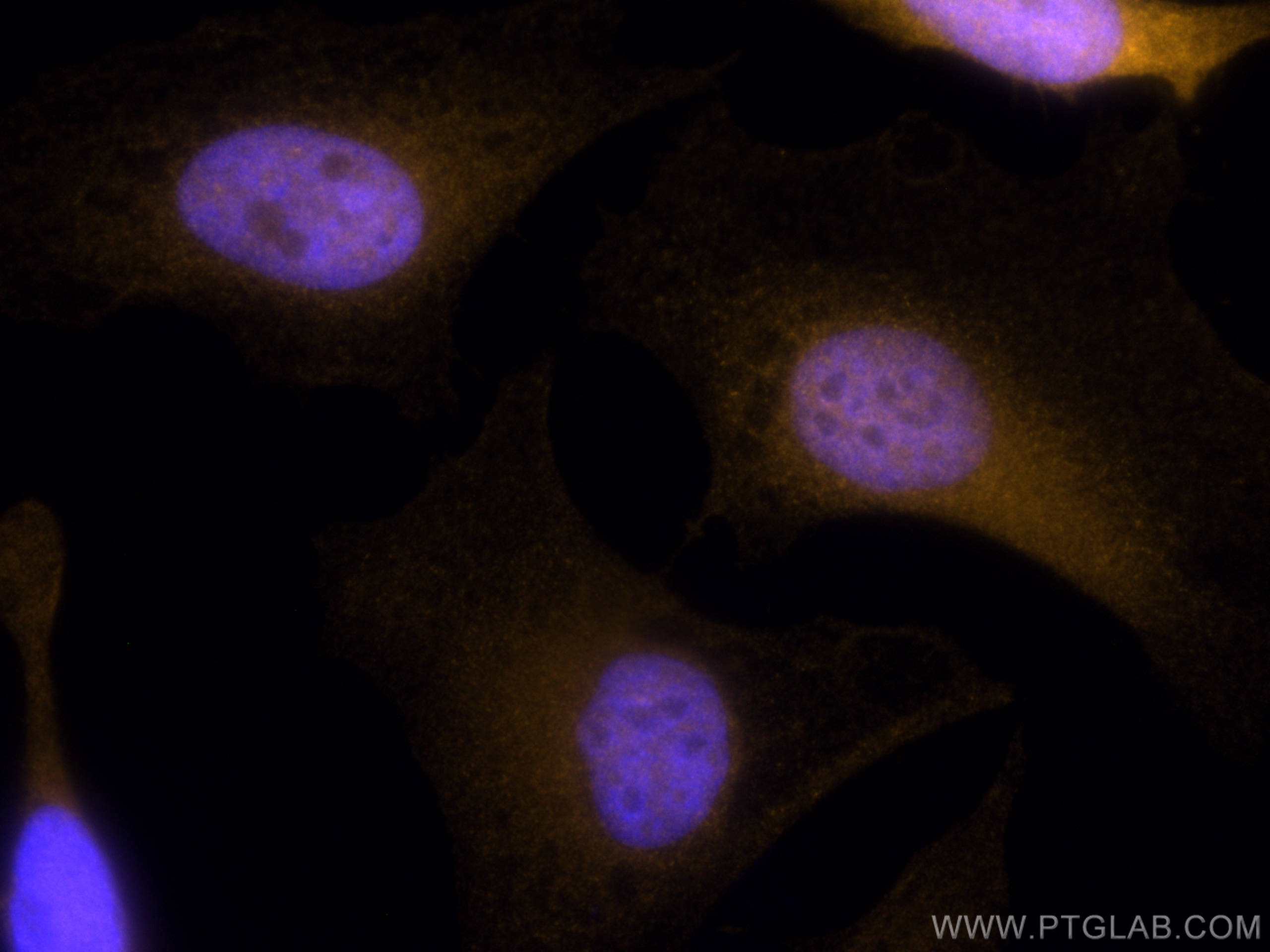 Thymidylate synthase