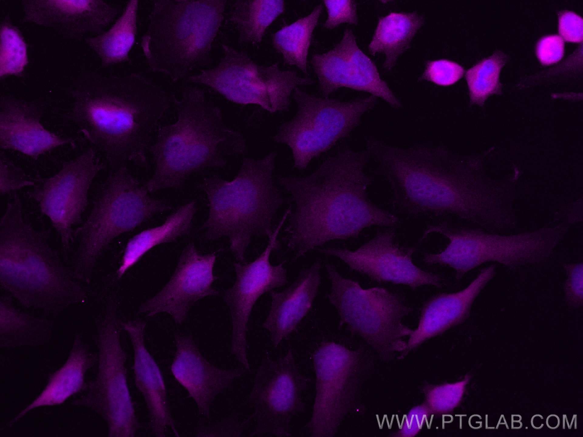 Thymidylate synthase