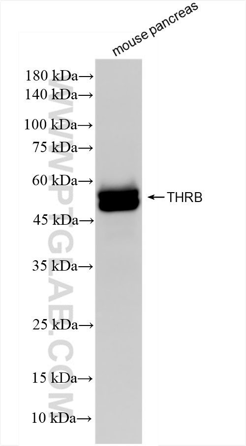 WB analysis of mouse pancreas using 83866-2-RR