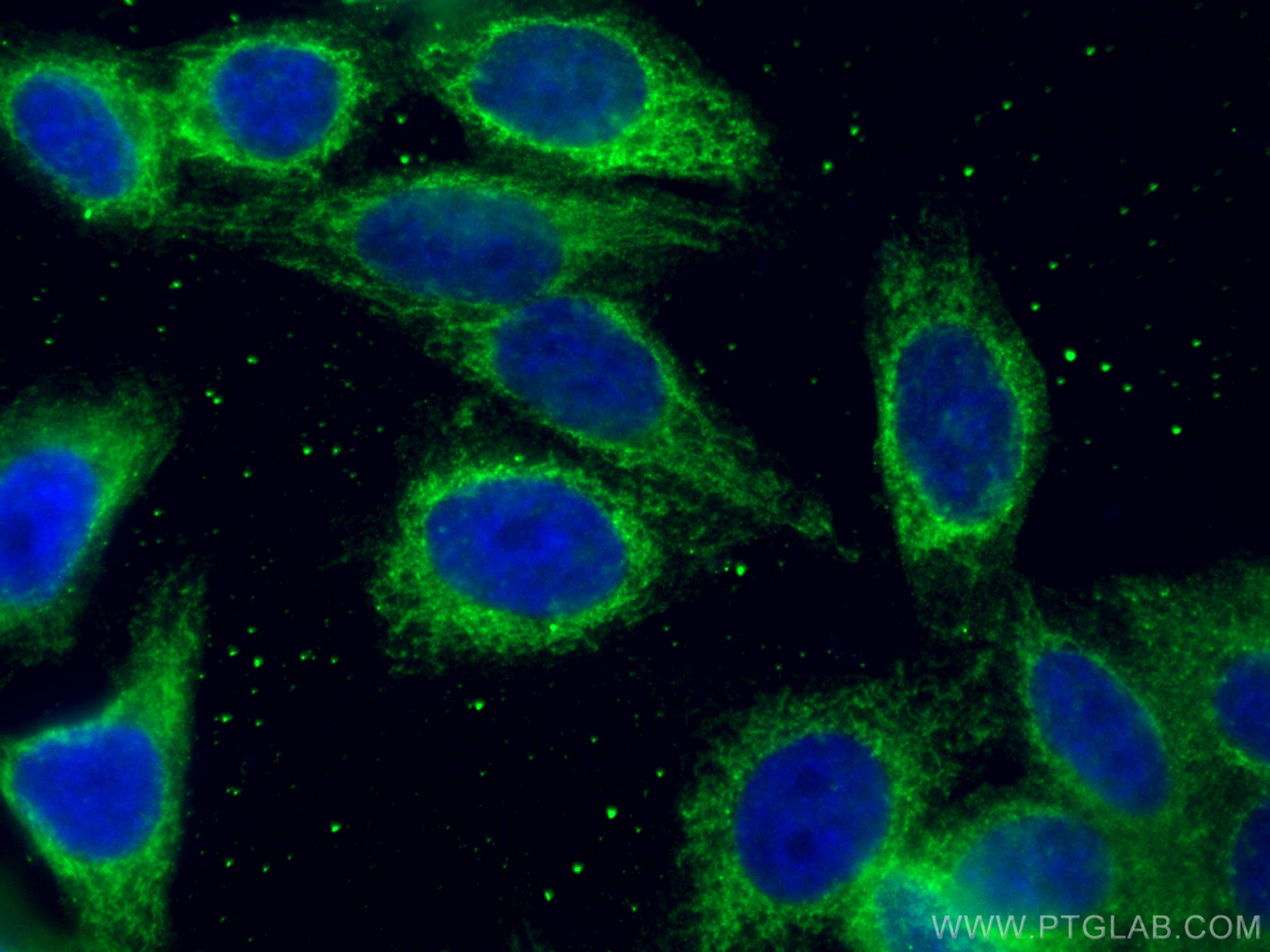 IF Staining of HepG2 using 67535-1-Ig (same clone as 67535-1-PBS)