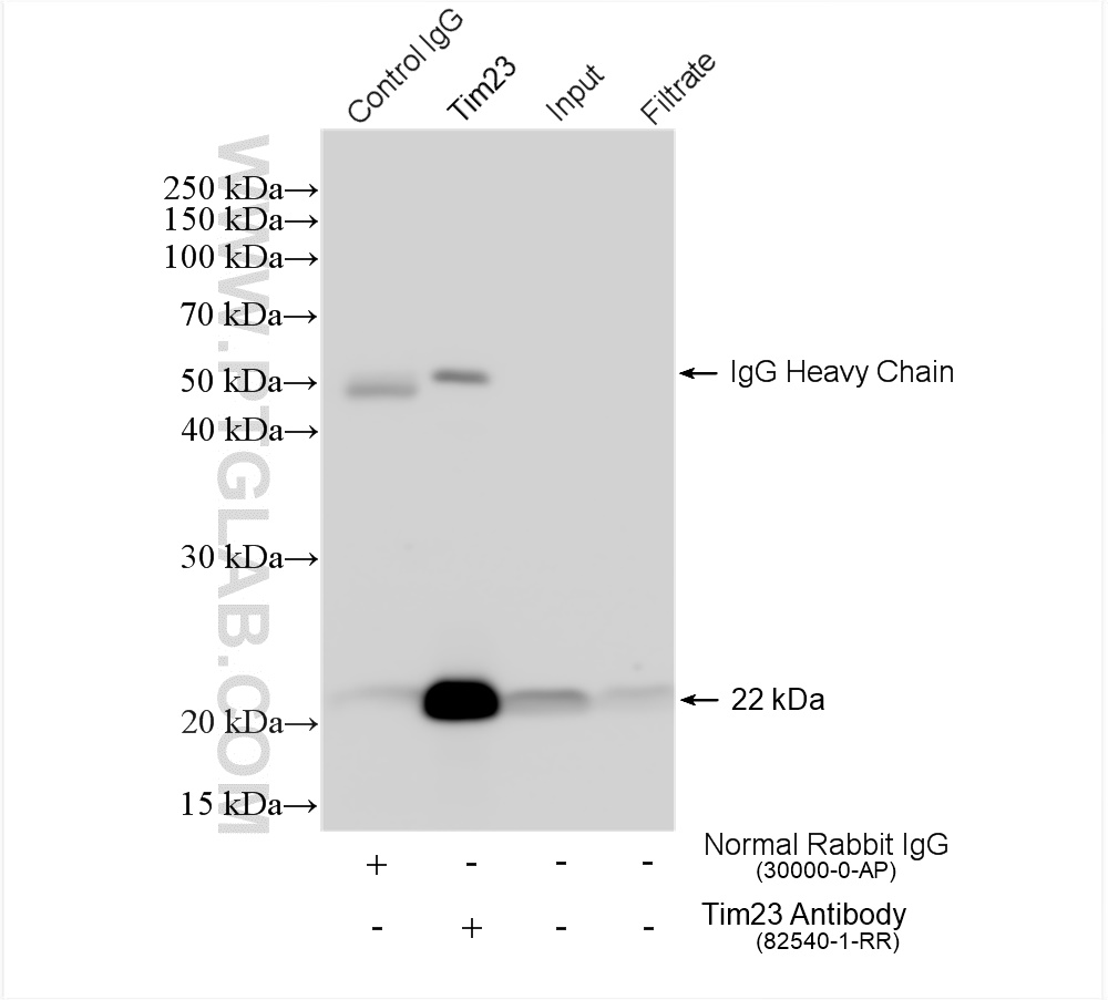 IP experiment of HeLa using 82540-1-RR