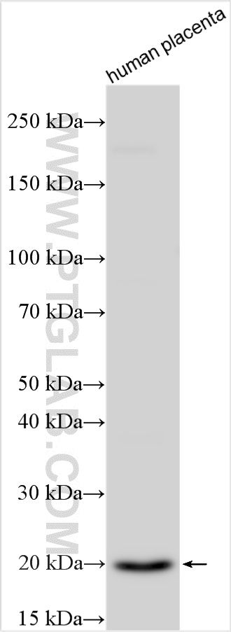 WB analysis using 31652-1-AP