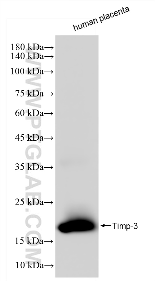 WB analysis of human placenta using 83627-1-RR (same clone as 83627-1-PBS)