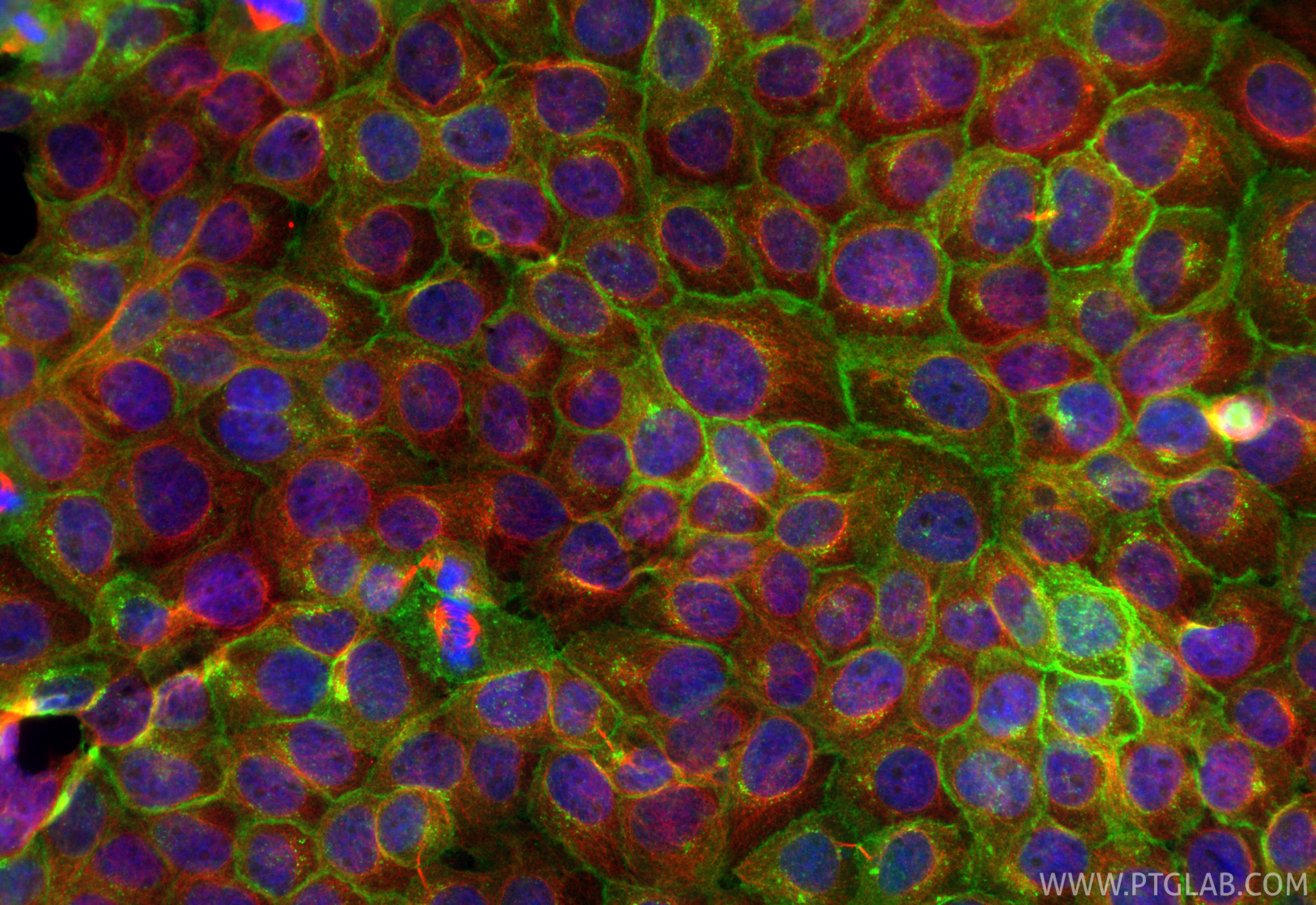 IF Staining of A431 using 31453-1-AP IF Staining of A431 using 31453-1-AP