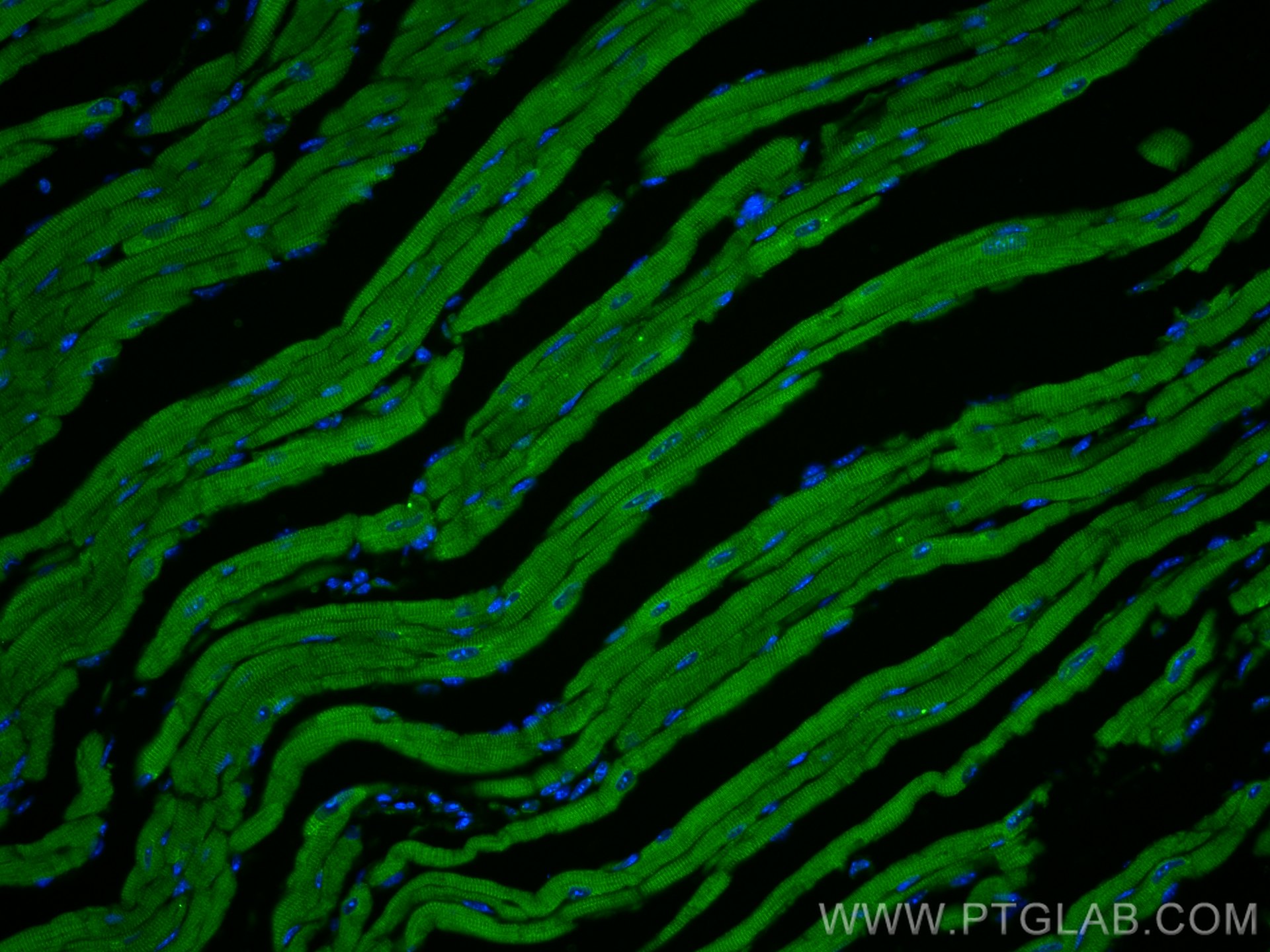 IF Staining of mouse heart using 27867-1-AP