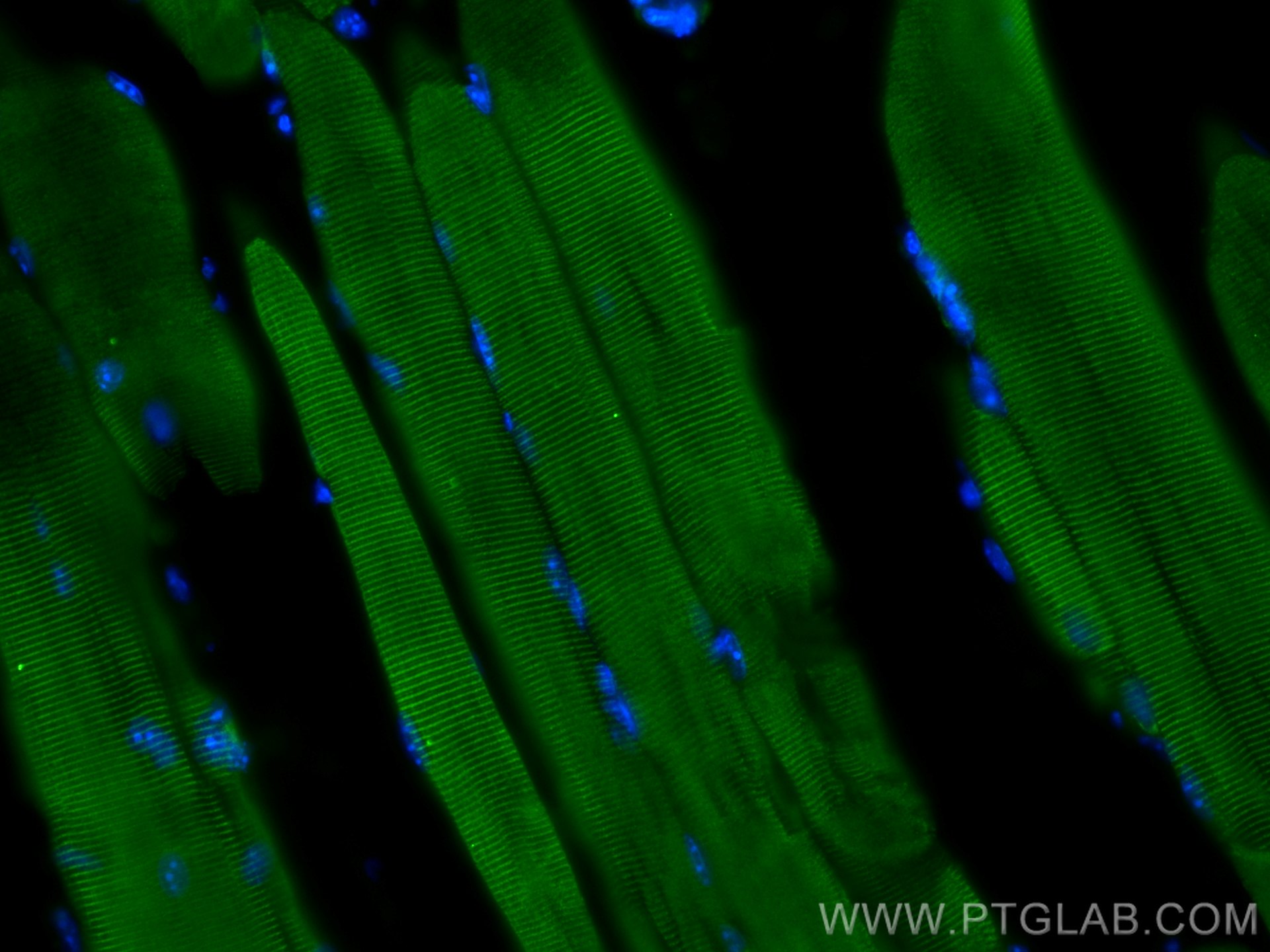 IF Staining of mouse skeletal muscle using 27867-1-AP