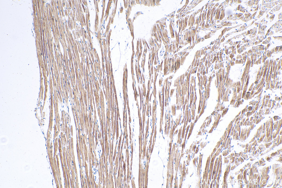 IHC staining of mouse heart using 27867-1-AP