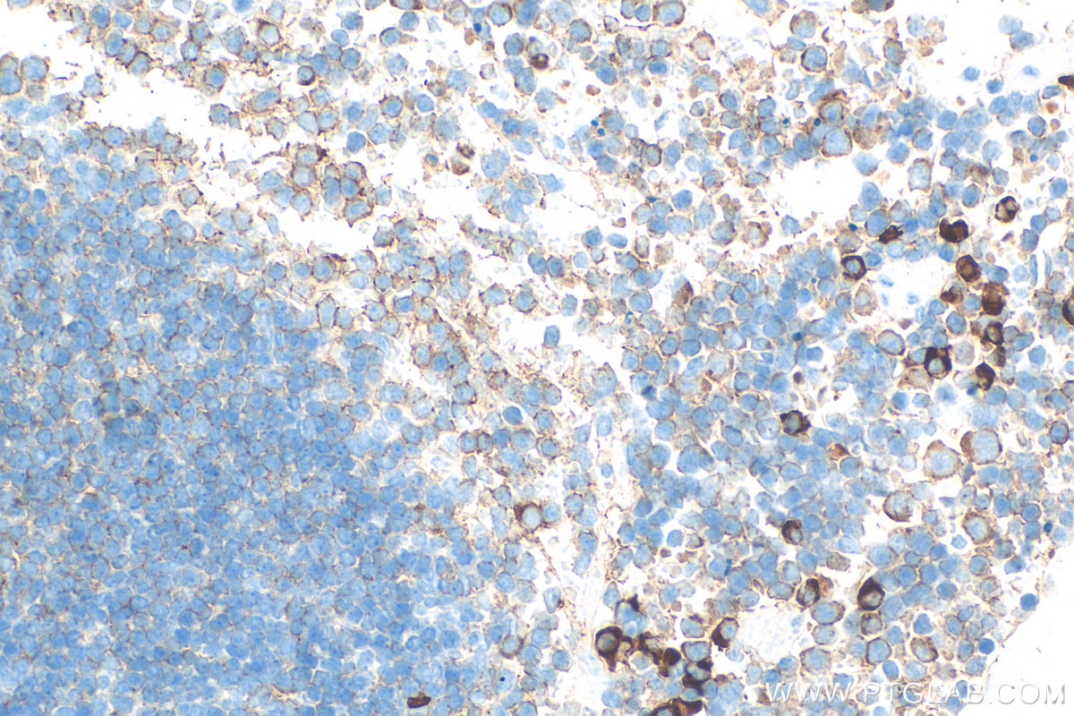 IHC staining of mouse spleen using 32743-1-AP