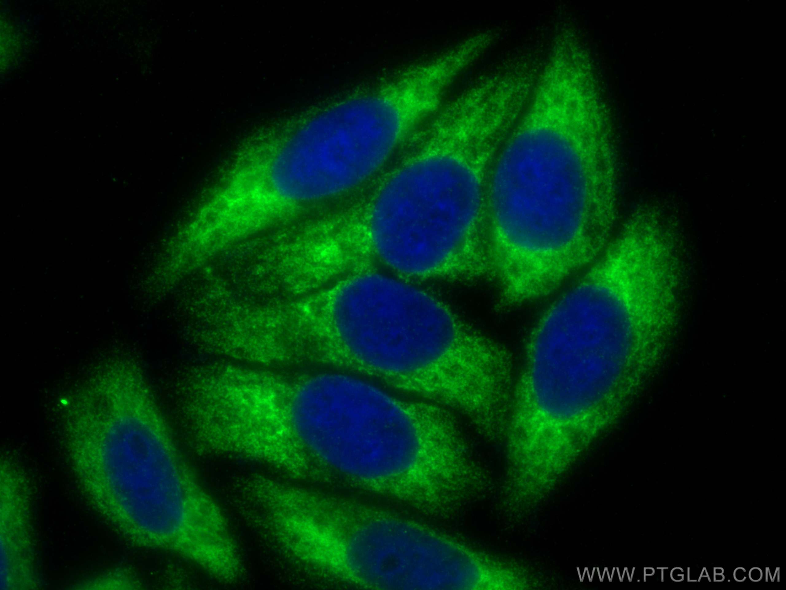 IF Staining of HepG2 using 15508-1-AP