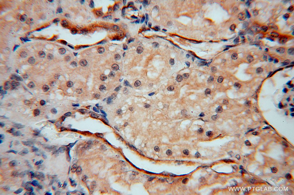 IHC staining of human kidney using 15508-1-AP