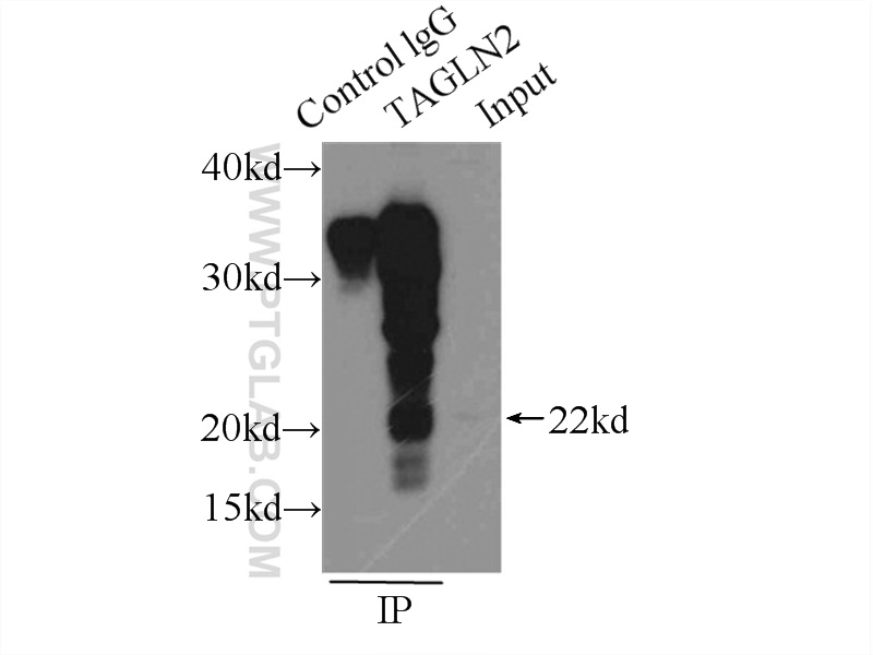 IP experiment of L02 using 15508-1-AP