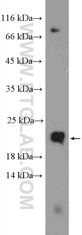 WB analysis of HeLa using 15508-1-AP