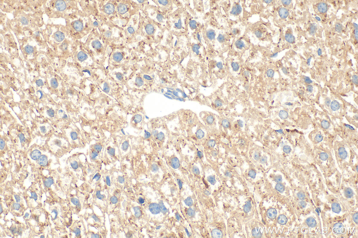 IHC staining of mouse liver using 31130-1-AP